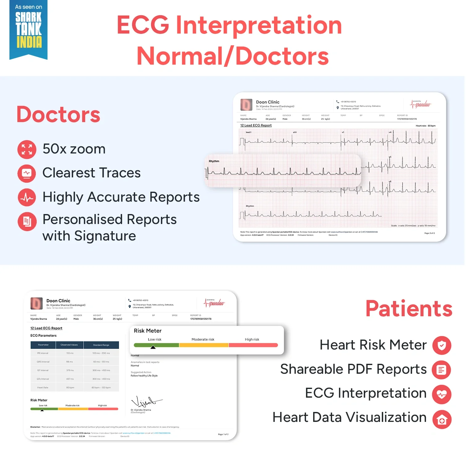 Sunfox : Spandan 4.0 12- Lead Portable ECG Device - Image 3